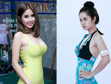 Sự thay đổi vóc dáng của nữ diễn viên Thảo Trang trước và sau phẫu thuật.