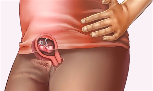 cách giữ vòng 1 khi mang thai